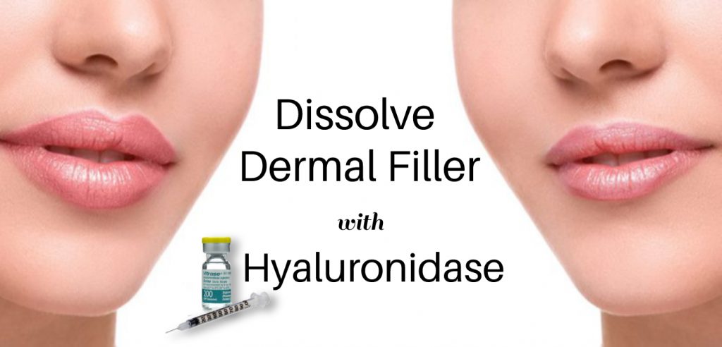 cheshire wellness clinic Hyaluronidase Filler Dissolve